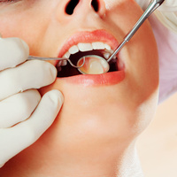 Наложение пародонтальной повязки в области одного зуба